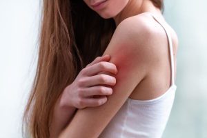 young woman suffering from itching her skin scratching itchy place s