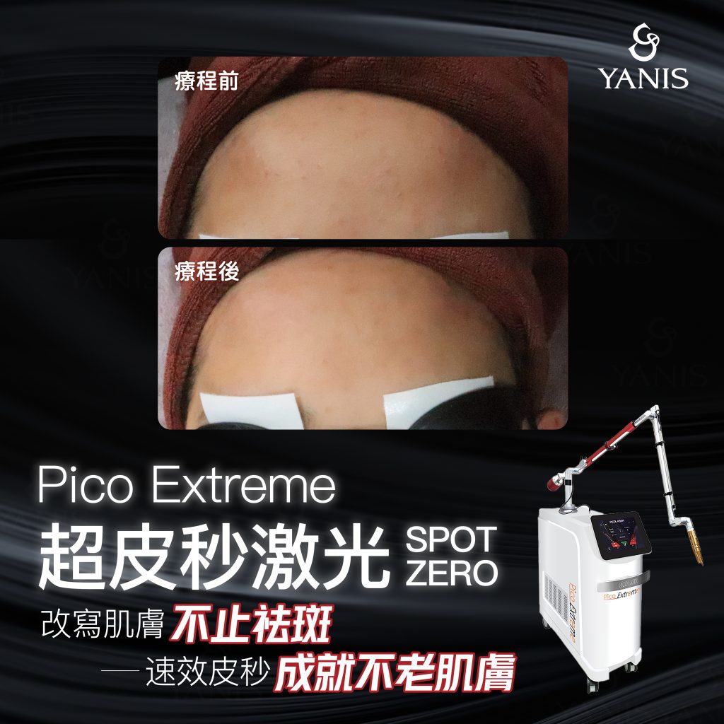 Pico Extreme 面 效果 01