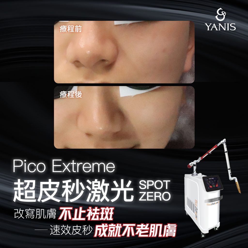 Pico Extreme 面 效果 02