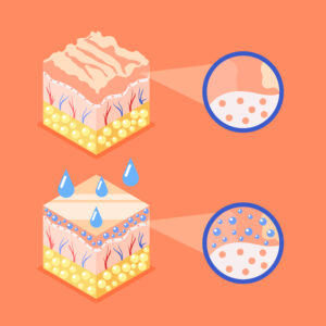 33770716 2208.i301.007.F.m004.c9.FP hyaluronic acid isometric background