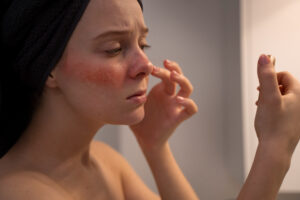 woman looking her rosacea mirror