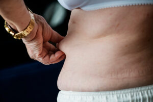 closeup obese elderly woman