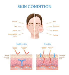 26762490 2202.q703.020.S.m004.c12.skin anatomy layers structure 1