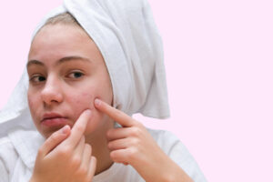 acne teenage girl squeezing out pimples her face