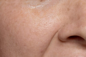 close up face pores texture 1