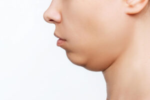 cropped shot young caucasian woman s face with double chin isolated white background