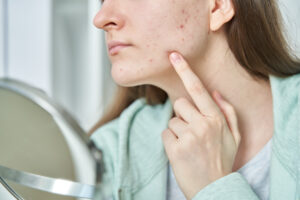 portrait young teenage girl having problems with skin checking touching irritated face