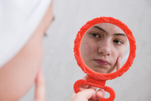 sad teenage girl problematic skin adolescents