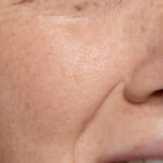 close up face pores texture 2