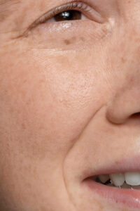 close up face pores texture 2