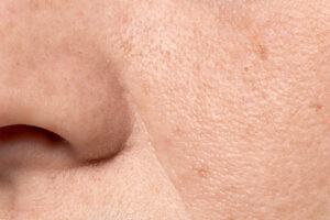 close up face pores texture 4