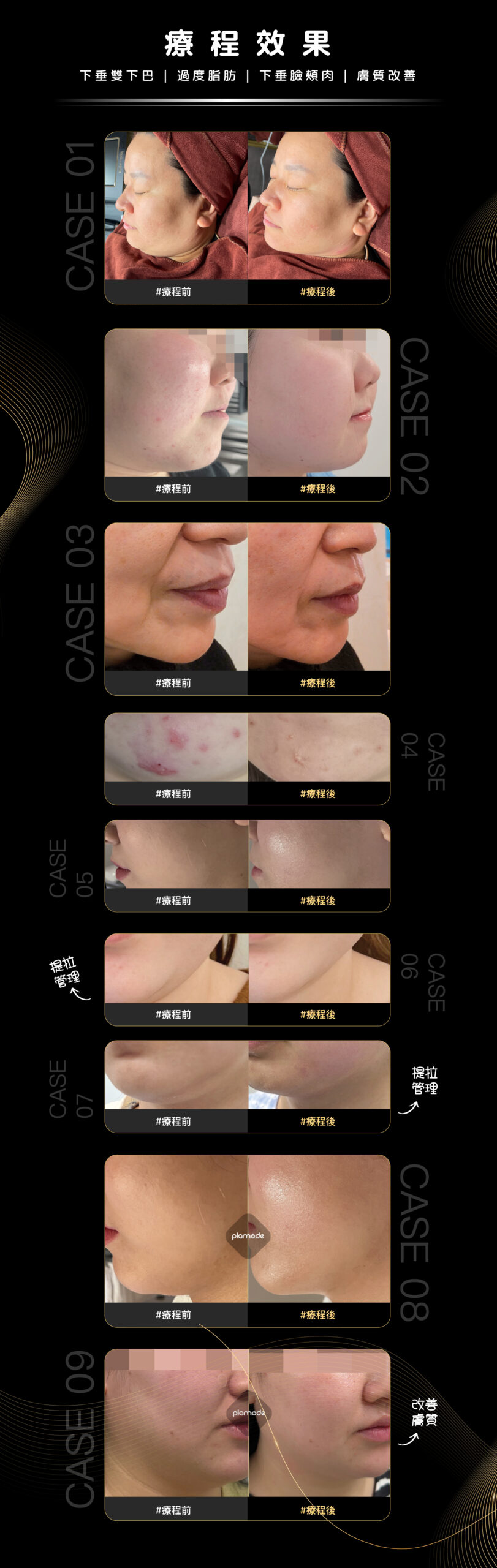 YB Web Plamode黑金鋼 2 08 scaled