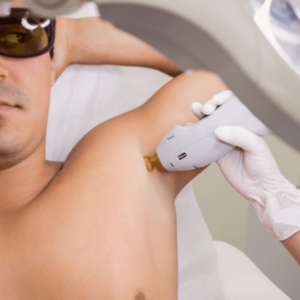 doctor performing laser hair removal male patient skin 107420 65228