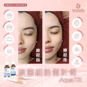 AquaTX液態細胞微針術一次 (全面)