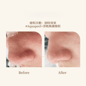 《一場來自水的淨化肌膚革命,讓你的臉重新學會呼吸》 3 pic2 1 768x768 1